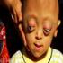 Уродливые дети – результат химических атак США во Вьетнаме