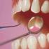 Плохие зубы могут быть признаком психического недуга