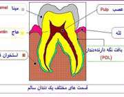 مراحل پُر کردن دندان(با تصاویر)