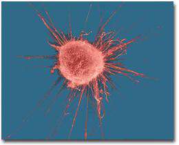 چند مثال از یوکاریوت ها