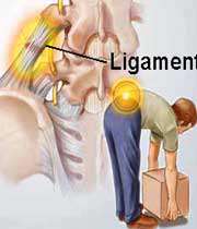 آسیب مهره های کمر