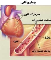 بیماری قلبی