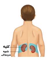 کلیه های کودک