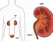 کليه