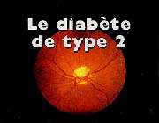 le diabète de type 2