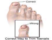 correct way to trim toenails