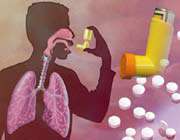 asthma 
