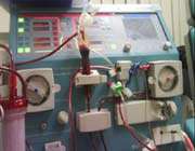 dialysis machine 