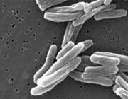 iranians find new strains of tuberculosis