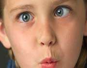 strabismus