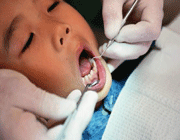زيارة الطفل لطبيب الأسنان