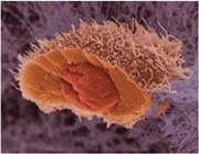 une cellule cancéreuse