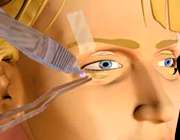 جراحی پلاستیک چشم