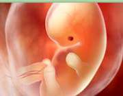 miscarriages increases heart attack risk