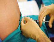 spinal anesthesia