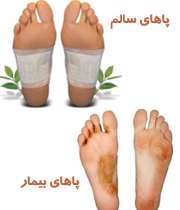 سلامت پاها