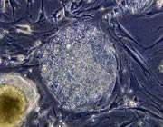 stem_cell_embryo