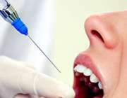 تزریق آمپول بی حسی در دندانپزشکی