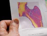 the dual-emission x-ray absorptiometry (dxa) of a hip bone