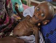 starvation -somalia