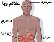 علائم بیماری وبا