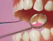 зубы