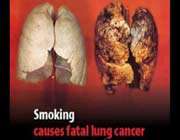 cigarette warning label