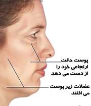 شل شدن پوست با افزایش سن