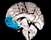 the frontal lobe highlighted in a brian mri