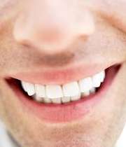 سفیدی دندان