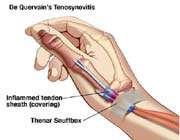 موبایل -تلفن همراه