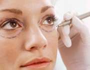 توصیه های لازم قبل از عمل جراحی زیبایی بینی 
