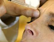 تزریق بوتاکس در پوست صورت