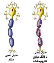 سلول عصبی در بیماری ام اس