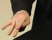  لرزش دست‌ها در بیماری پارکینسون 