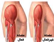 دیستروفی عضلانی