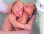 newborn twins believe theyre still in womb
