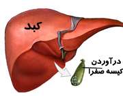 درآوردن کیسه صفرا با عمل جراحی 