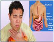 indigestion