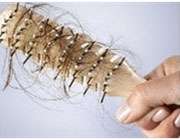 درمان قطعی ریزش مو با طب سنتی