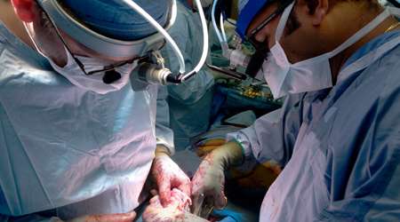 عمل جراحی پیوند قلب