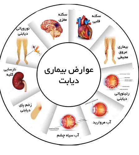 دیابت