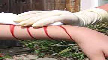 ساخت داروی ضد انعقاد خون در زخم های سطحی از پسماندهای گیاهان – جلسه سوم