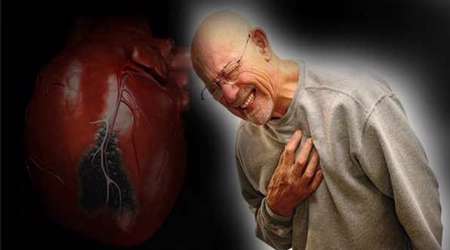 4 hal yang perlu diketahui tentang serangan jantung