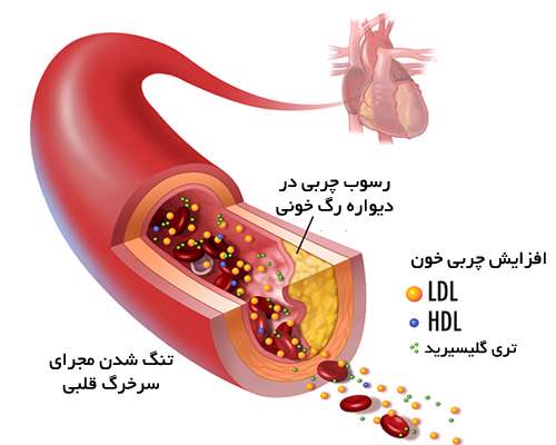 چربی خون