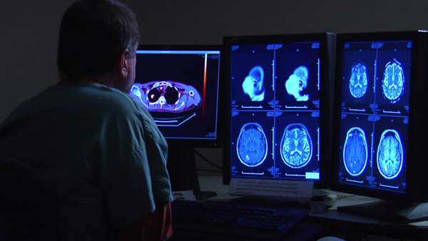 ام آر آى (mri) چیست؟