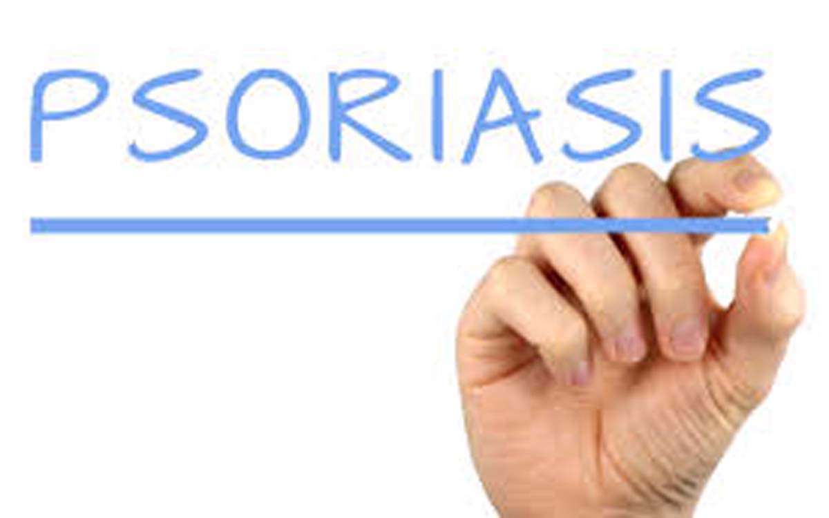 پسوریازیس زمینه ساز ابتلا به کدام بیماری ها است