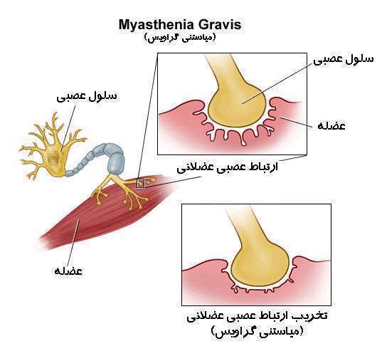 ارتباط عصبی عضلانی 