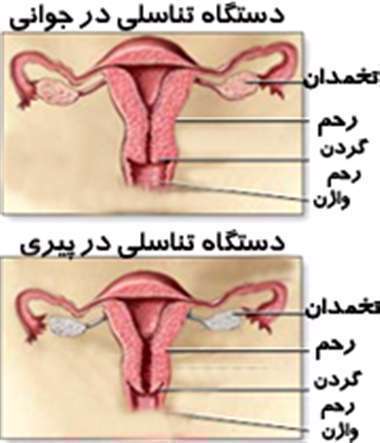 یائسگی - یائسه - تخمدان- رحم - پایان قاعدگی -