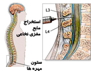 مایع مغزی نخاعی ،  سیستم عصبی مرکزی ،  دستگاه عصبی مرکزی ،